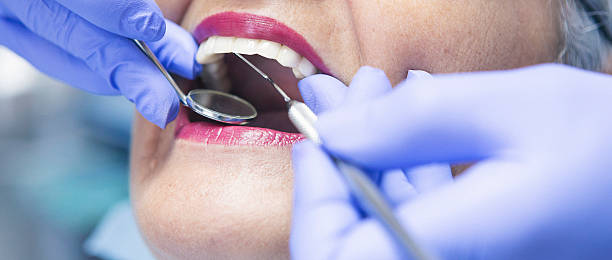Best Emergency Dental Care for Broken or Chipped Teeth in Bethel, OH